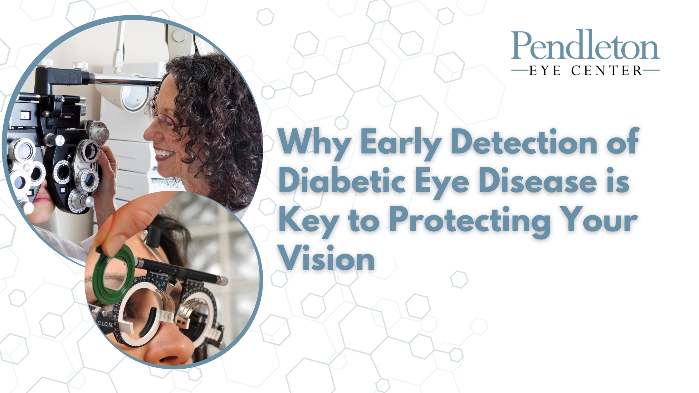 Why Early Detection of Diabetic Eye Disease is Key to Protecting Your Vision