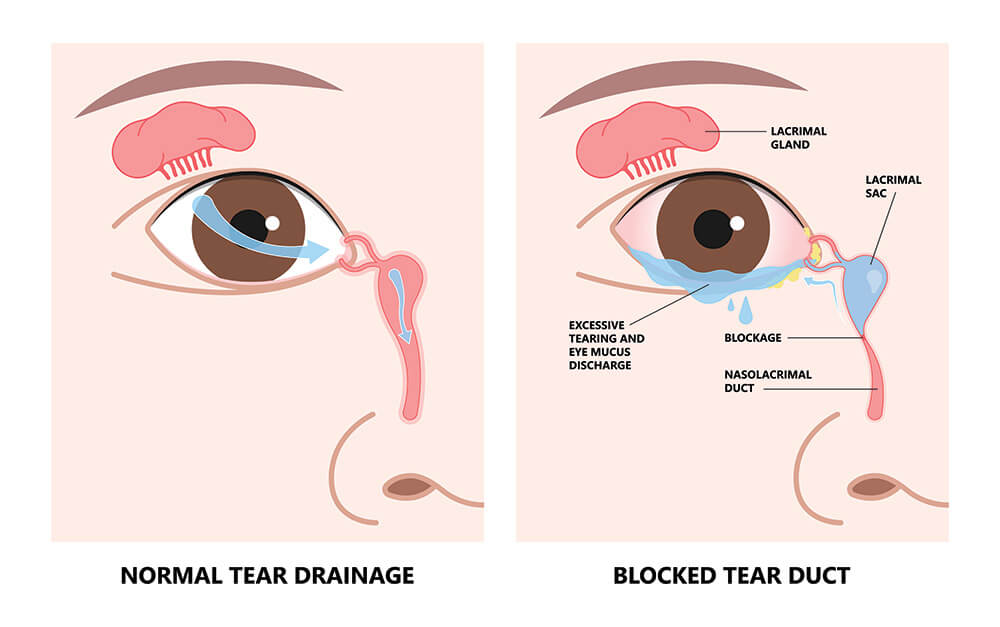 lacrimal gland