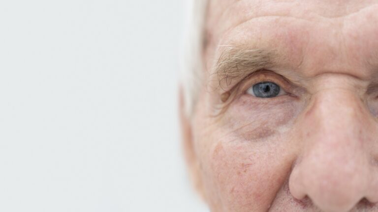 How Corneal Crosslinking Helps Patients with Keratoconus